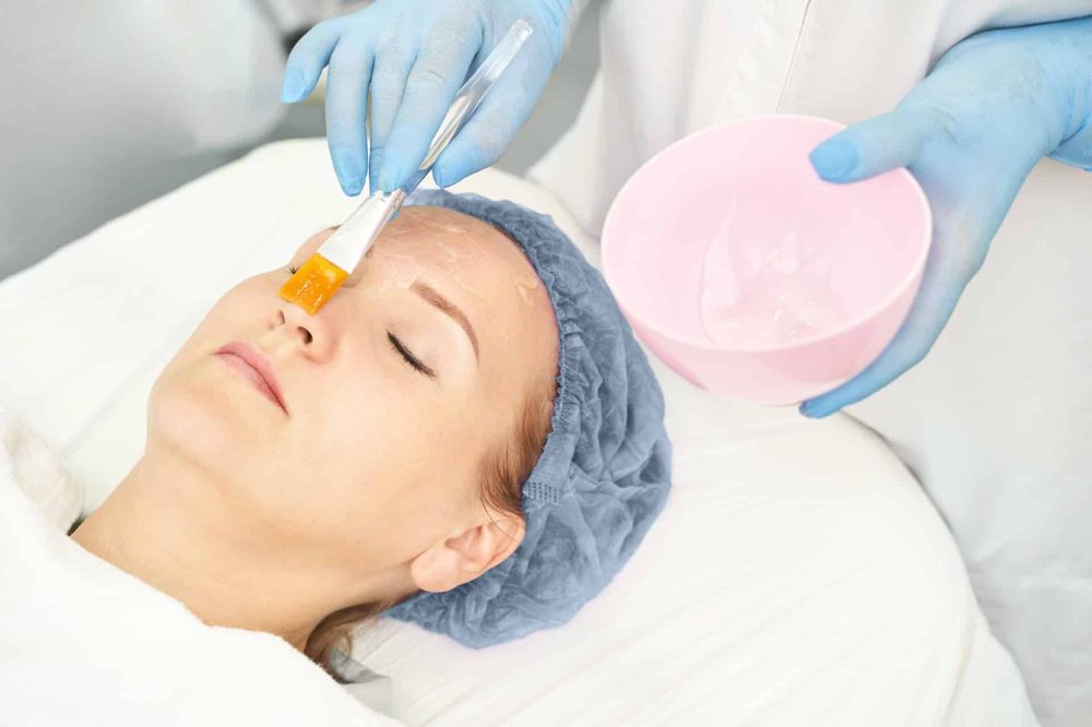 PRX-T33 kjemisk peeling
