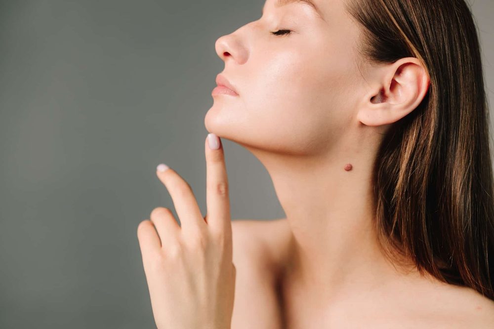 Sculptra-behandling